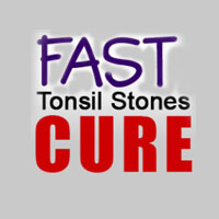 Fast Tonsil Stones Cure Coupon Codes and Deals