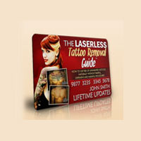 Laserlesstattooremoval Coupon Codes and Deals