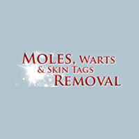 Moles, Warts & Skin Tags Removal Coupon Codes and Deals