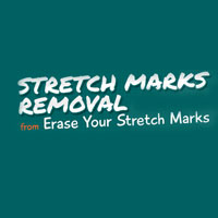 Erase Your Stretch Marks