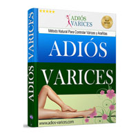 Adios Varices