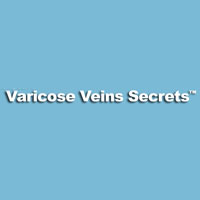 Varicose Veins Naturally